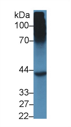 Sex Hormone Binding Globulin (SHBG) Mouse Polyclonal Antibody