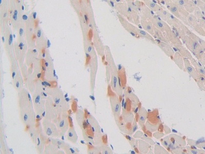 Sex Hormone Binding Globulin (SHBG) Mouse Polyclonal Antibody