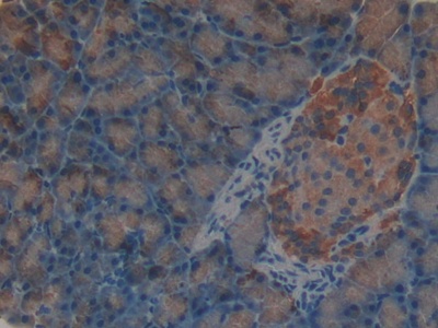 Sex Hormone Binding Globulin (SHBG) Rat Polyclonal Antibody