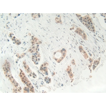 High Mobility Group Protein 1 (HMGB1) Human Polyclonal Antibody