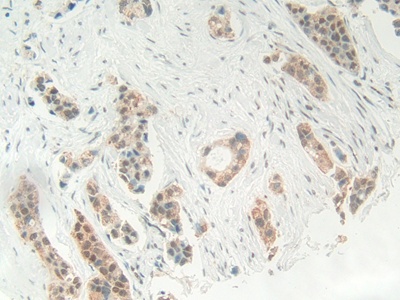 High Mobility Group Protein 1 (HMGB1) Human Polyclonal Antibody