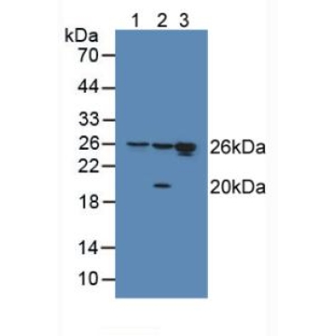 High Mobility Group Protein 1 (HMGB1) Human Polyclonal Antibody