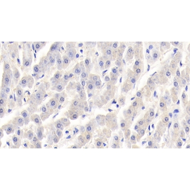 Retinol Binding Protein 1, Cellular (RBP1) Bovine (Cattle) Polyclonal Antibody
