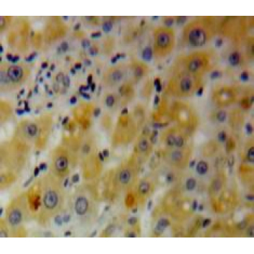 Pleckstrin Homology Like Domain Family A, Member 2 (PHLDA2) Human Polyclonal Antibody