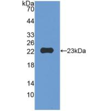 Matrix Metalloproteinase 12 (MMP12) Mouse Polyclonal Antibody