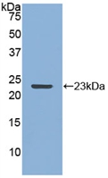 Matrix Metalloproteinase 12 (MMP12) Rabbit Polyclonal Antibody
