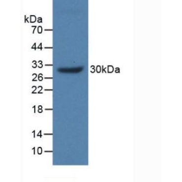 Mucin 17 (MUC17) Human Polyclonal Antibody