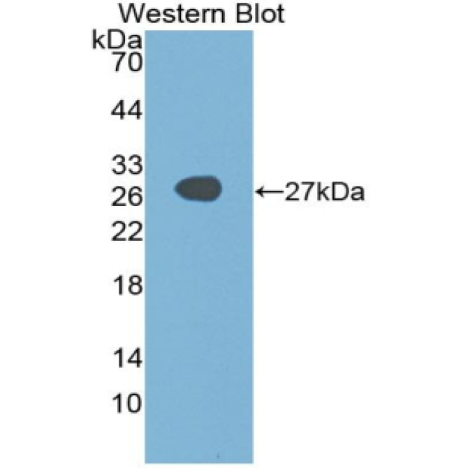 Sex Determining Region Y Box Protein 2 (SOX2) Human Polyclonal Antibody