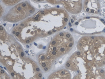 Kallikrein 9 (KLK9) Human Polyclonal Antibody