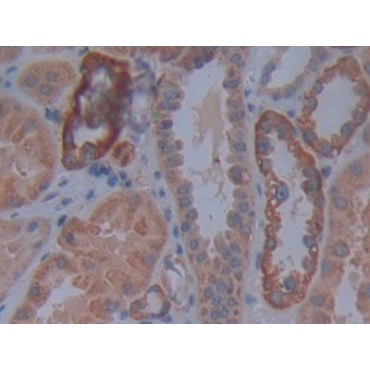 Cadherin, Retinal (RCAD) Human Polyclonal Antibody