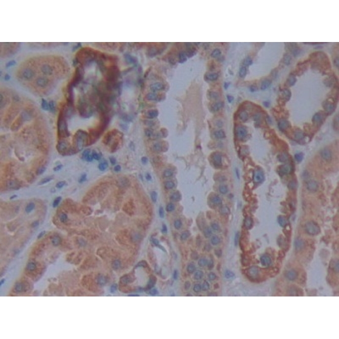 Cadherin, Retinal (RCAD) Human Polyclonal Antibody