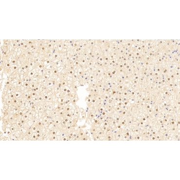 GATA Binding Protein 3 (GATA3) Human Polyclonal Antibody