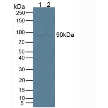 Phospholipase A2, Calcium Independent (iPLA2) Human Polyclonal Antibody