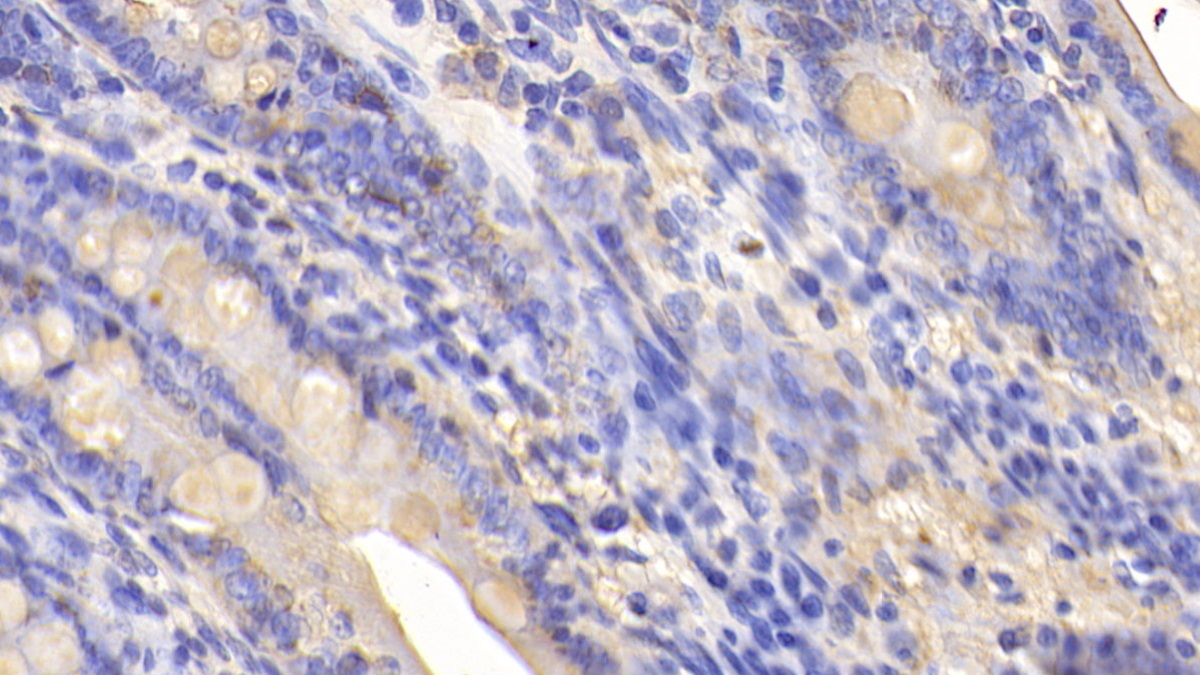 Phospholipase A2, Calcium Independent (iPLA2) Rat Polyclonal Antibody