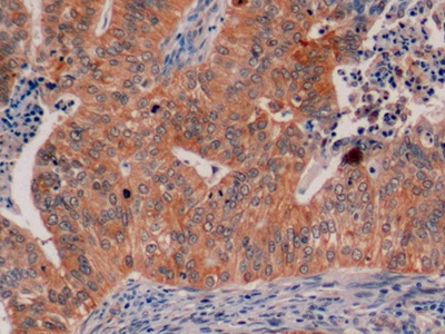 Mucin 1 (MUC1) Pan-species (General) Polyclonal Antibody