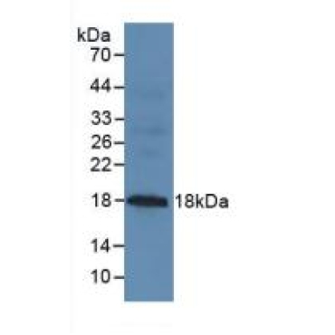 Mucin 1 (MUC1) Human Polyclonal Antibody