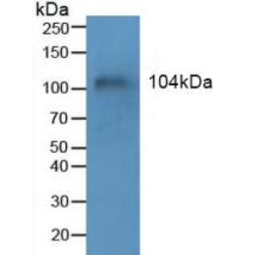 Mucin 1 (MUC1) Human Polyclonal Antibody