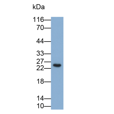 Mucin 1 (MUC1) Mouse Polyclonal Antibody