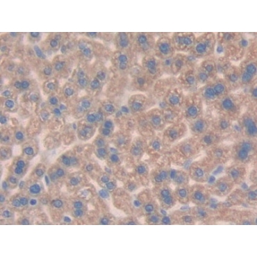 Mucin 1 (MUC1) Mouse Polyclonal Antibody