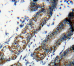 Mucin 1 (MUC1) Rat Polyclonal Antibody