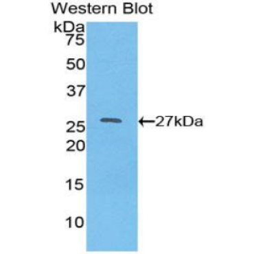 Hepatocyte Nuclear Factor 4 Alpha (HNF4a) Human Polyclonal Antibody