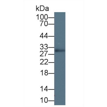 Myelin Oligodendrocyte Glycoprotein (MOG) Human Polyclonal Antibody