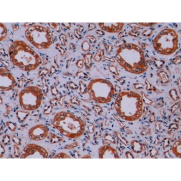 Synaptophysin (SYP) Human, Mouse, Rat Polyclonal Antibody