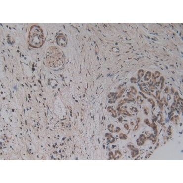 Apoptosis Associated Tyrosine Kinase (AATK) Human Polyclonal Antibody