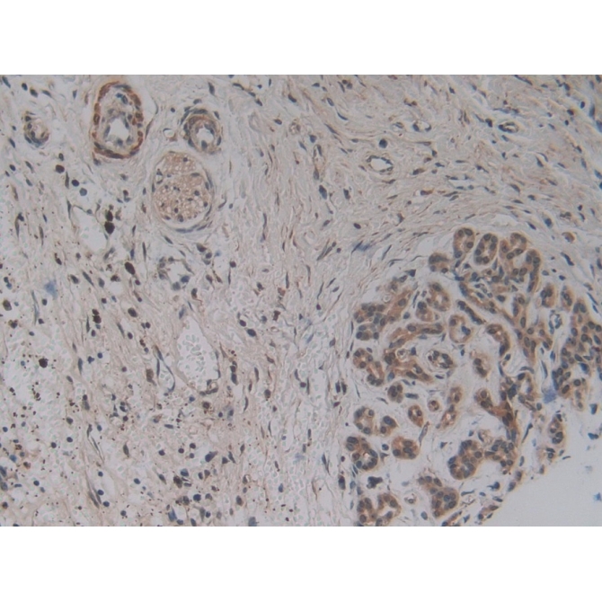 Apoptosis Associated Tyrosine Kinase (AATK) Human Polyclonal Antibody