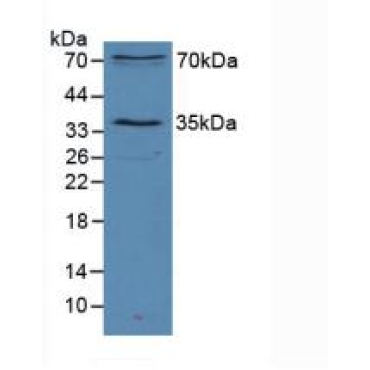 Sirtuin 2 (SIRT2) Human Polyclonal Antibody