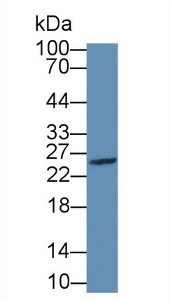 Granzyme M (GZMM) Human Polyclonal Antibody