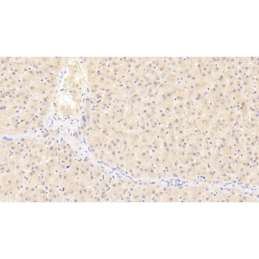 Protein Kinase C Delta (PKCd) Human Polyclonal Antibody