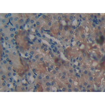 Protein Kinase C Delta (PKCd) Mouse Polyclonal Antibody