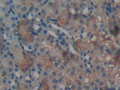 Protein Kinase C Delta (PKCd) Mouse Polyclonal Antibody
