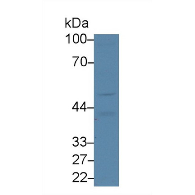5T4 Human Polyclonal Antibody