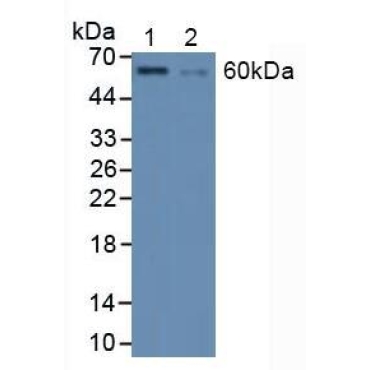 Heat Shock Transcription Factor 1 (HSF1) Human Polyclonal Antibody