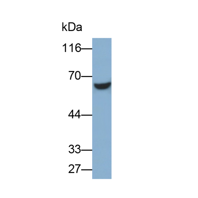 Estrogen Receptor Beta (ERb) Human Polyclonal Antibody