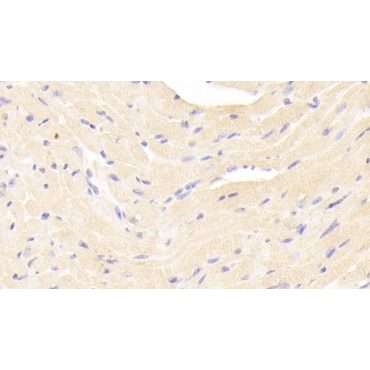 Estrogen Receptor Beta (ERb) Mouse Polyclonal Antibody