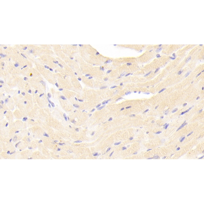 Estrogen Receptor Beta (ERb) Mouse Polyclonal Antibody