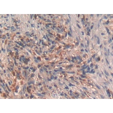 Growth Hormone Releasing Hormone (GHRH) Human Polyclonal Antibody