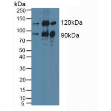 Protein Kinase C Epsilon (PKCe) Human Polyclonal Antibody