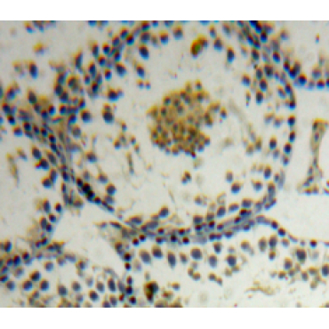 Apoptosis Antagonizing Transcription Factor (AATF) Human Polyclonal Antibody