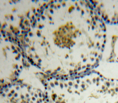 Apoptosis Antagonizing Transcription Factor (AATF) Human Polyclonal Antibody