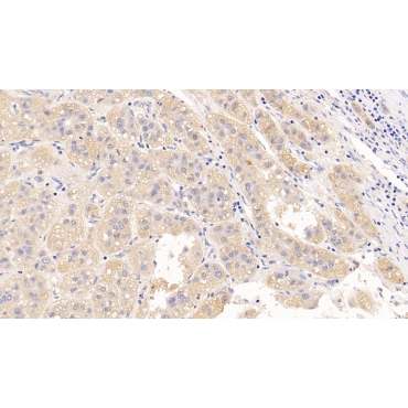 Luteinizing Hormone (LH) Human Polyclonal Antibody