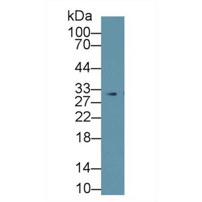 Prohibitin (PHB) Human Polyclonal Antibody