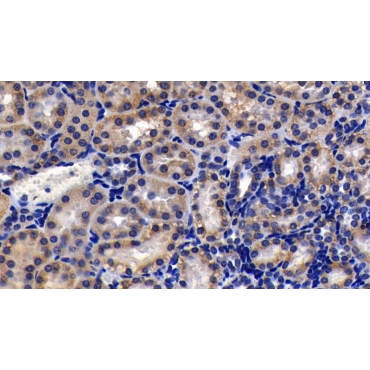 Prohibitin (PHB) Human Polyclonal Antibody