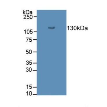 Desmoglein 3 (DSG3) Human Polyclonal Antibody
