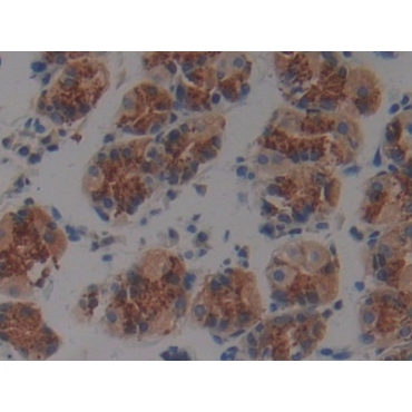 Plakophilin 2 (PKP2) Human Polyclonal Antibody