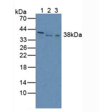 Inhibin Beta C (INHbC) Human Polyclonal Antibody