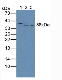Inhibin Beta C (INHbC) Human Polyclonal Antibody